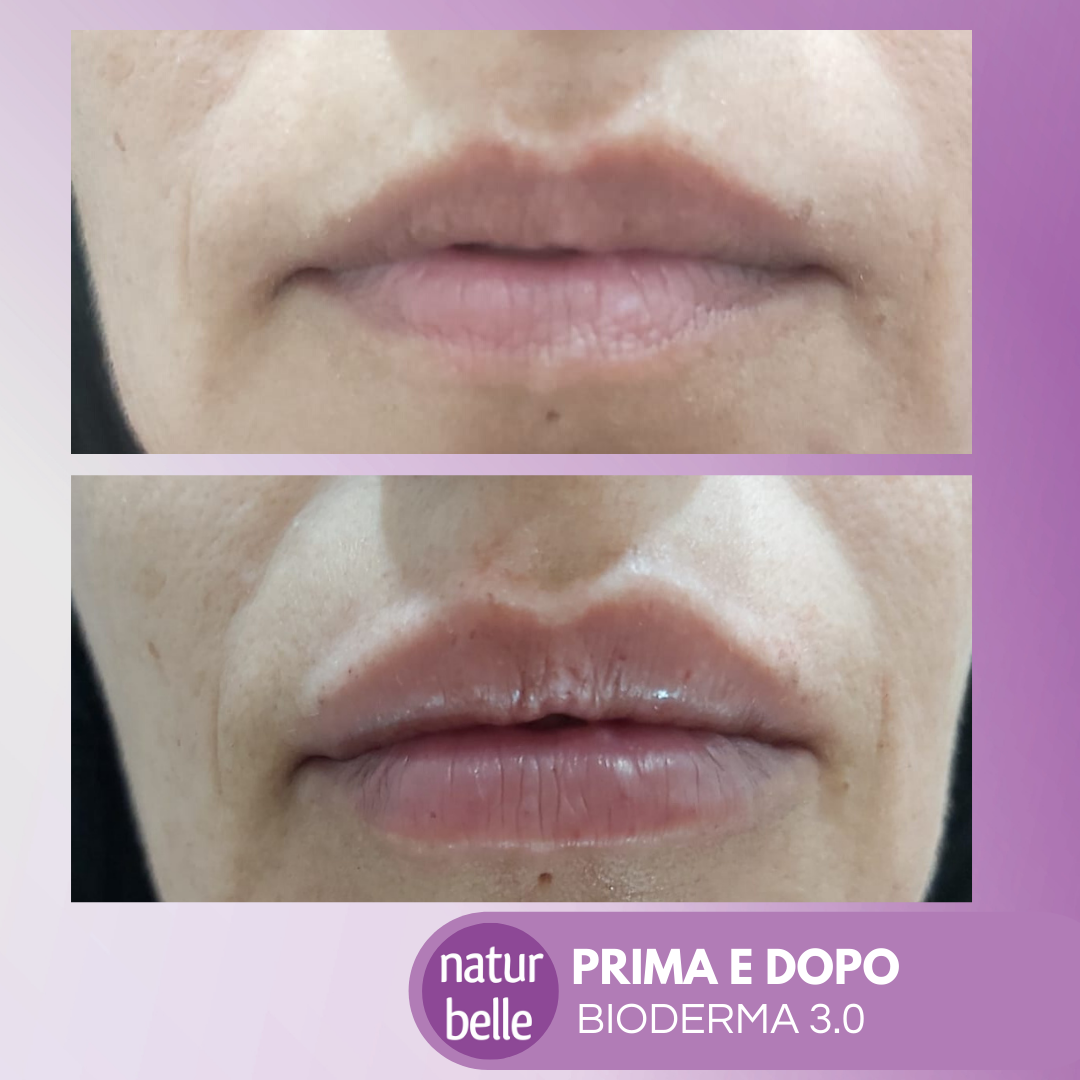 bioderma prima dopo 2